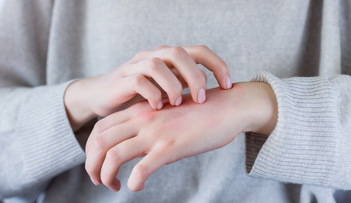 アレルギーを発症するイメージ